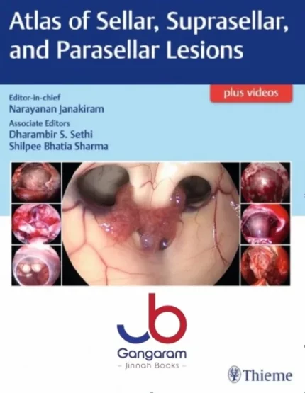 Atlas of Sellar, Suprasellar, and Parasellar Lesions 1st Edition