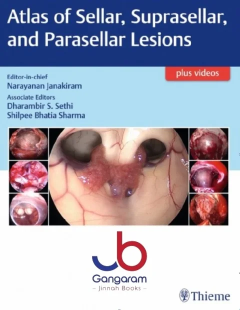 Atlas of Sellar, Suprasellar, and Parasellar Lesions 1st Edition