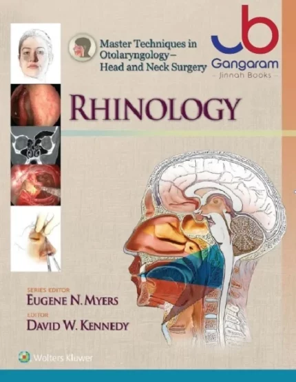 Master Techniques in Otolaryngology Head and Neck Surgery Rhinology By Wolters Kluwer
